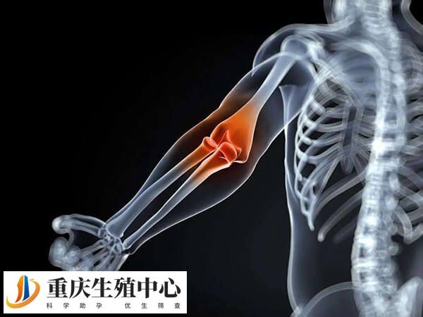 网球肘是肘部肌腱的慢性劳损性疾病